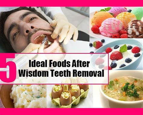 Can I Eat Solid Food 3 Days After Tooth Extraction? And Why Do Bananas Always Seem to Disappear When You Need Them Most?